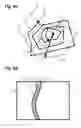 Fig. 08 - Process of treating a workpiece using a liquid jet guided laser beam