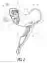 Fig. 03 - Bicycle operating device
