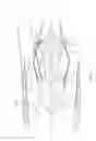 Fig. 02 - Nacelle bifurcation with leading edge structure