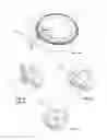 Fig. 07 - Pull-tab tamper evident container