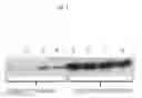 Fig. 02 - METHOD FOR PREPARATION OF N-ACYL PEPTIDES, POLYPEPTIDES AND PROTEINS