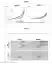 Fig. 04 - Process for preparing biocompatible and biodegradable porous three-dimensional polymer matrices and uses thereof