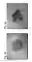 Fig. 02 - Methods of microbial oil extraction and separation