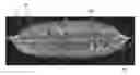 Fig. 01 - WATER-SOLUBLE UNIT DOSE ARTICLES COMPRISING WATER-SOLUBLE FIBROUS STRUCTURES AND PARTICLES