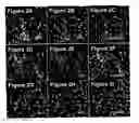Fig. 04 - DIFFERENTIATION OF HUMAN IPS CELLS TO HUMAN ALVEOLAR TYPE II VIA DEFINITIVE ENDODERM