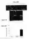 Fig. 06 - DIFFERENTIATION OF HUMAN IPS CELLS TO HUMAN ALVEOLAR TYPE II VIA DEFINITIVE ENDODERM
