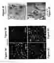 Fig. 07 - DIFFERENTIATION OF HUMAN IPS CELLS TO HUMAN ALVEOLAR TYPE II VIA DEFINITIVE ENDODERM