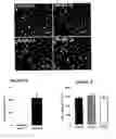 Fig. 22 - DIFFERENTIATION OF HUMAN IPS CELLS TO HUMAN ALVEOLAR TYPE II VIA DEFINITIVE ENDODERM