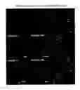 Fig. 43 - DIFFERENTIATION OF HUMAN IPS CELLS TO HUMAN ALVEOLAR TYPE II VIA DEFINITIVE ENDODERM