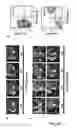 Fig. 07 - PROCESS FOR INDUCING RESISTANCE TO DIPHTHERIA TOXIN IN HUMAN CELLS, PRODUCTS AND USES THEREOF