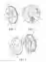Fig. 02 - Scissor gear assembly