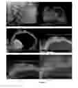 Fig. 05 - Kit, Composition and Method for Preparing a Specimen for Imaging and Method for Diagnosing a Disease