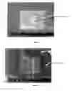 Fig. 08 - Kit, Composition and Method for Preparing a Specimen for Imaging and Method for Diagnosing a Disease