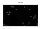 Fig. 10 - Apparatus and method for acquiring fluorescence image