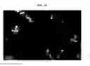 Fig. 11 - Apparatus and method for acquiring fluorescence image