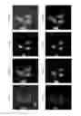 Fig. 13 - Apparatus and method for acquiring fluorescence image