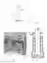 Fig. 03 - Particles in liquid detection method and particles in liquid detection system and method to detect particles in the air
