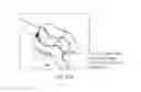 Fig. 43 - Devices and methods for diagnosis of sinusitis