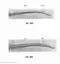 Fig. 49 - Devices and methods for diagnosis of sinusitis
