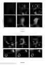 Fig. 06 - PROTEOMIC ANALYSIS OF SUBCELLULAR COMPARTMENTS