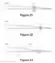 Fig. 16 - High etendue modular zoom lens for machine vision having five lens groups