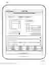 Fig. 08 - Deal-Surfacing Button