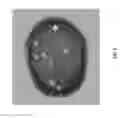 Fig. 06 - System and method for detecting brain metastases
