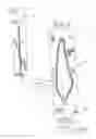 Fig. 04 - METHOD AND APPARATUS FOR MENTALLY STIMULATING A PERSON WITH A MENTAL DISABILITY