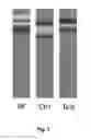 Fig. 02 - NUTRITIONAL COMPOSITIONS WITH 2FL AND LNNT FOR USE IN INDUCING A GUT MICROBIOTA CLOSE TO THE ONE OF BREAST FED INFANTS