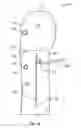 Fig. 07 - Patient Mittens