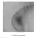 Fig. 22 - Image-based global registration system and method applicable to bronchoscopy guidance