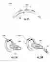 Fig. 09 - Wearable apparatus