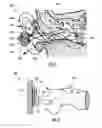 Fig. 05 - Apparatus, systems and methods for obtaining cleaner physiological information signals