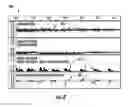 Fig. 06 - Apparatus, systems and methods for obtaining cleaner physiological information signals