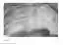 Fig. 09 - Method for evaluating blush in myocardial tissue