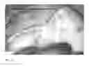 Fig. 10 - Method for evaluating blush in myocardial tissue