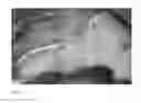 Fig. 12 - Method for evaluating blush in myocardial tissue