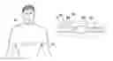 Fig. 01 - EMI protection for physiological measurements