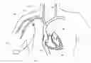 Fig. 01 - Devices and methods for vascular navigation, assessment and/or diagnosis