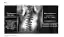 Fig. 17 - CHEST MEASURING DEVICE, SCOLIOSIS CORRECTION SYSTEM, SYSTEM FOR REMOTELY DIAGNOSING SPINE, AND WEARABLE MEASURING DEVICE