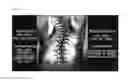 Fig. 17 - CHEST MEASURING DEVICE, SCOLIOSIS CORRECTION SYSTEM, SYSTEM FOR REMOTELY DIAGNOSING SPINE, AND WEARABLE MEASURING DEVICE