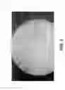 Fig. 06 - Bladder mapping