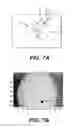 Fig. 08 - Bladder mapping
