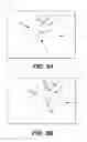Fig. 09 - Bladder mapping
