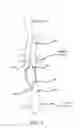 Fig. 03 - Devices and methods for measurement of Vena Cava dimensions, pressure and oxygen saturation