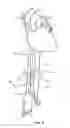 Fig. 10 - Devices and methods for measurement of Vena Cava dimensions, pressure and oxygen saturation