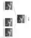 Fig. 07 - SYSTEM AND METHOD FOR ACCELERATED CLUTTER FILTERING IN ULTRASOUND BLOOD FLOW IMAGING USING RANDOMIZED ULTRASOUND DATA