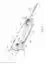 Fig. 03 - Biopsy system