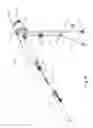 Fig. 05 - Biopsy system