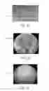 Fig. 09 - Flexible Biopsy Device